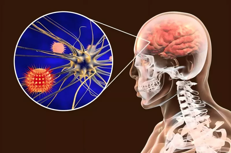 Meningococcus elleni vakcina útmutató